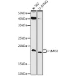 Western Blot - Anti-LMO2 Antibody [ARC1422] (A307847) - Antibodies.com