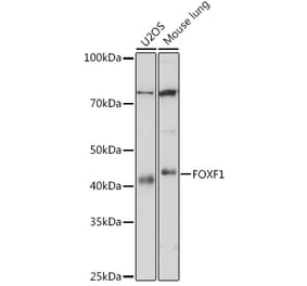 Western Blot - Anti-FOXF1 Antibody [ARC1863] (A307848) - Antibodies.com