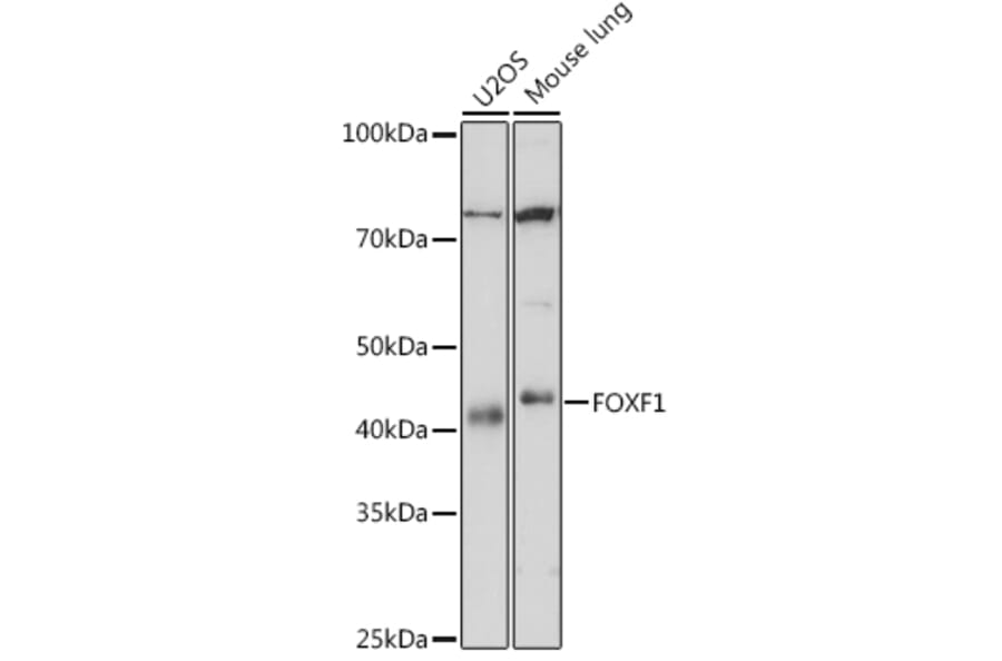 Western Blot - Anti-FOXF1 Antibody [ARC1863] (A307848) - Antibodies.com