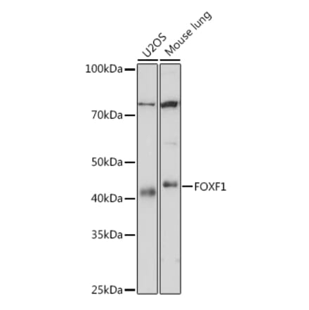 Western Blot - Anti-FOXF1 Antibody [ARC1863] (A307848) - Antibodies.com