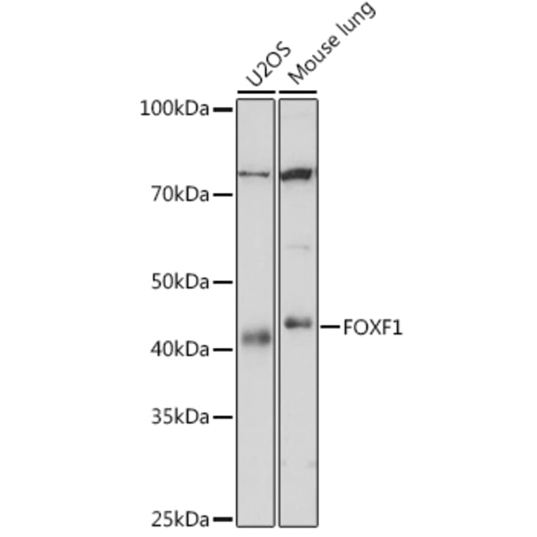Western Blot - Anti-FOXF1 Antibody [ARC1863] (A307848) - Antibodies.com