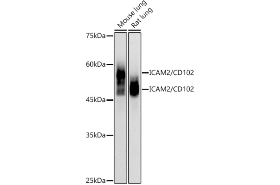 Western Blot - Anti-ICAM2 Antibody [ARC2802] (A307850) - Antibodies.com