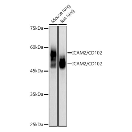 Western Blot - Anti-ICAM2 Antibody [ARC2802] (A307850) - Antibodies.com