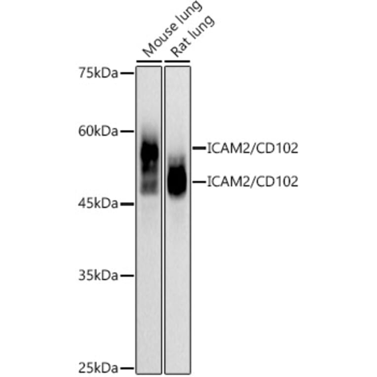 Western Blot - Anti-ICAM2 Antibody [ARC2802] (A307850) - Antibodies.com