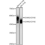 Western Blot - Anti-ICAM2 Antibody [ARC2802] (A307850) - Antibodies.com