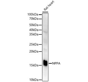 Western Blot - Anti-Natriuretic peptides A Antibody [ARC51463] (A307851) - Antibodies.com