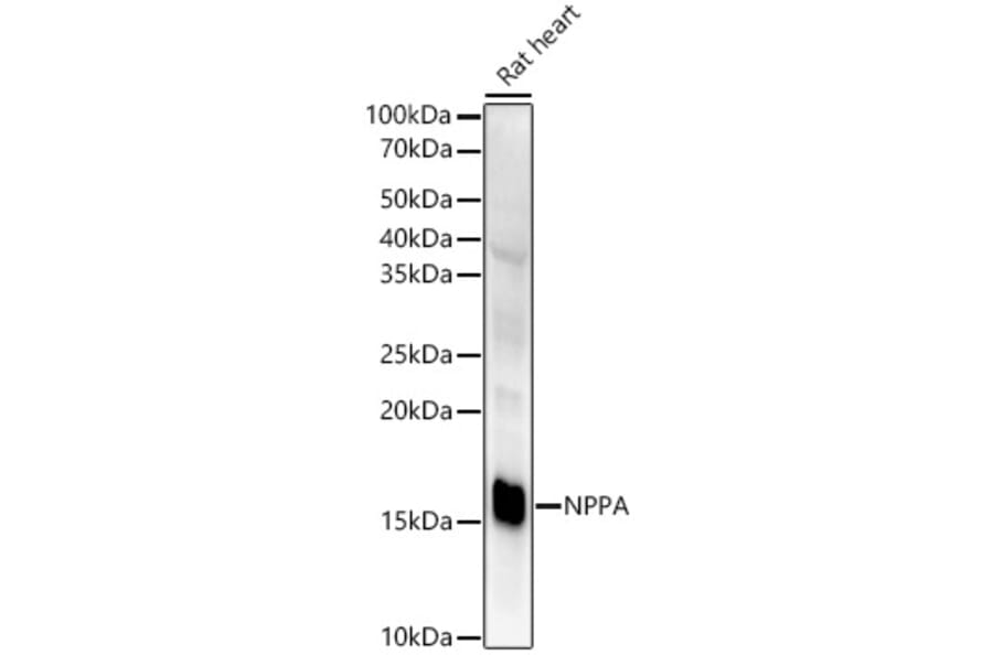 Western Blot - Anti-Natriuretic peptides A Antibody [ARC51463] (A307851) - Antibodies.com