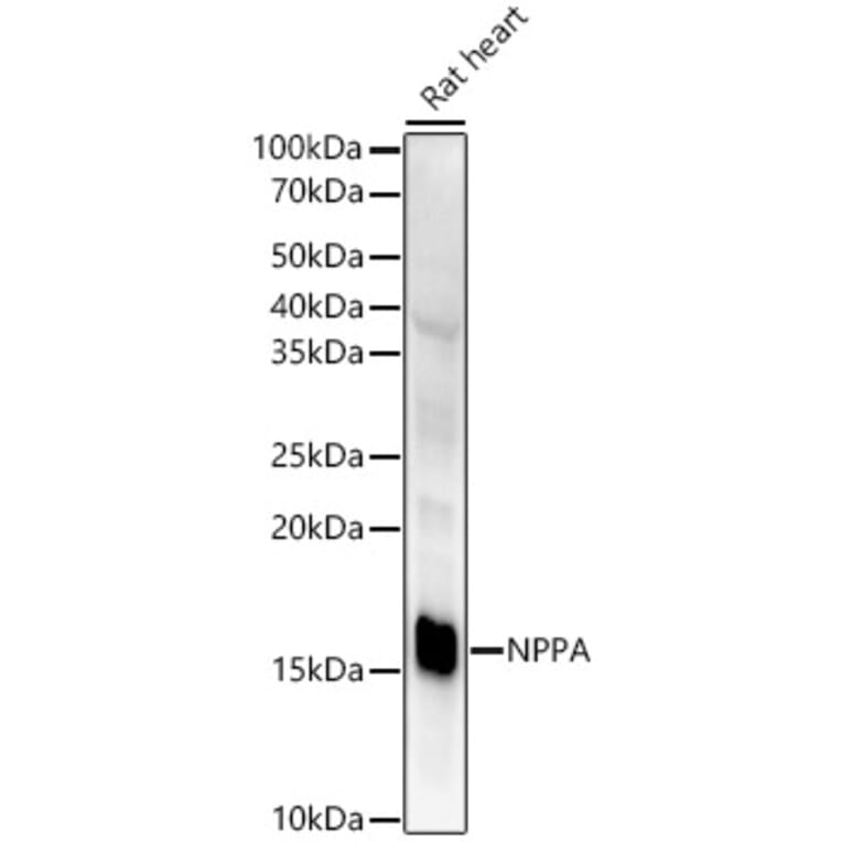 Western Blot - Anti-Natriuretic peptides A Antibody [ARC51463] (A307851) - Antibodies.com