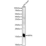 Western Blot - Anti-Natriuretic peptides A Antibody [ARC51463] (A307851) - Antibodies.com