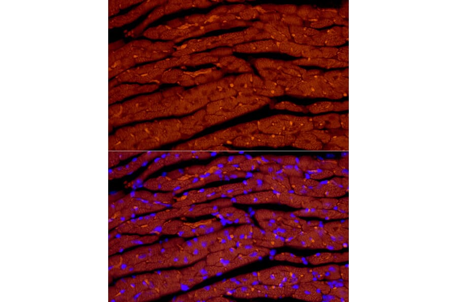 Immunofluorescence - Anti-Natriuretic peptides A Antibody [ARC51463] (A307851) - Antibodies.com