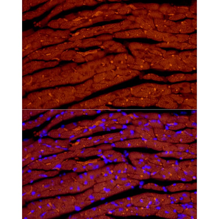 Immunofluorescence - Anti-Natriuretic peptides A Antibody [ARC51463] (A307851) - Antibodies.com