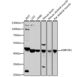Western Blot - Anti-ADIPOR1 Antibody (A307854) - Antibodies.com