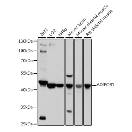 Western Blot - Anti-ADIPOR1 Antibody (A307854) - Antibodies.com
