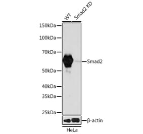Western Blot - Anti-Smad2 Antibody [ARC0343] (A307856) - Antibodies.com