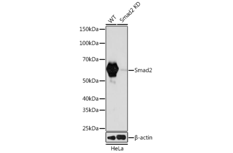 Western Blot - Anti-Smad2 Antibody [ARC0343] (A307856) - Antibodies.com