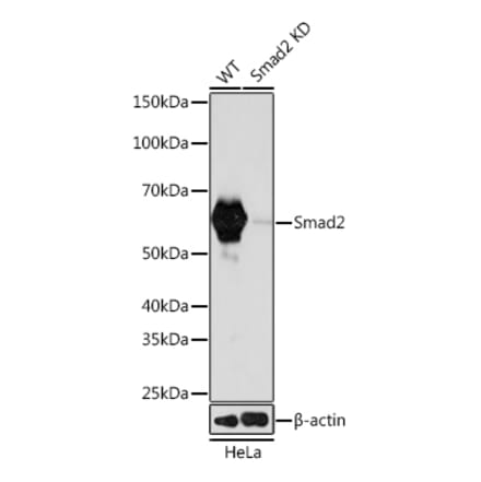 Western Blot - Anti-Smad2 Antibody [ARC0343] (A307856) - Antibodies.com