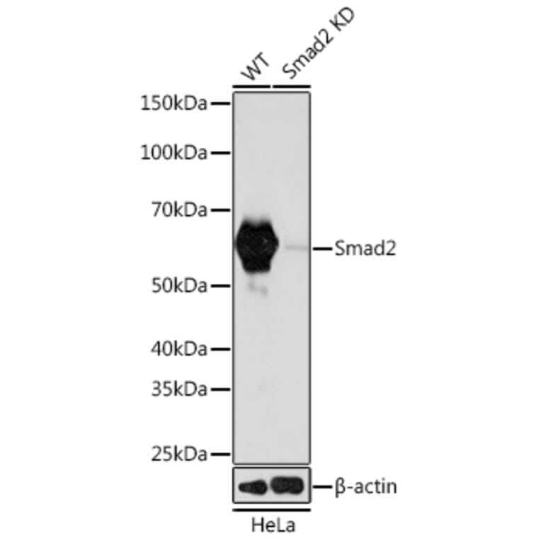 Western Blot - Anti-Smad2 Antibody [ARC0343] (A307856) - Antibodies.com