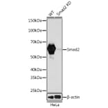 Western Blot - Anti-Smad2 Antibody [ARC0343] (A307856) - Antibodies.com