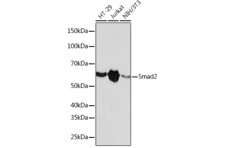 Western Blot - Anti-Smad2 Antibody [ARC0343] (A307856) - Antibodies.com