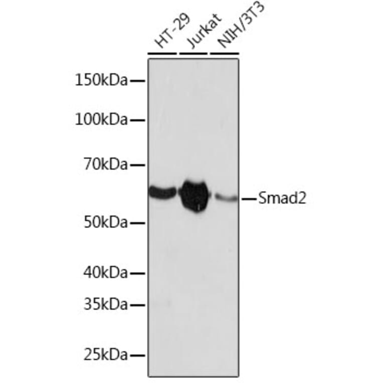 Western Blot - Anti-Smad2 Antibody [ARC0343] (A307856) - Antibodies.com