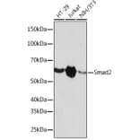 Western Blot - Anti-Smad2 Antibody [ARC0343] (A307856) - Antibodies.com