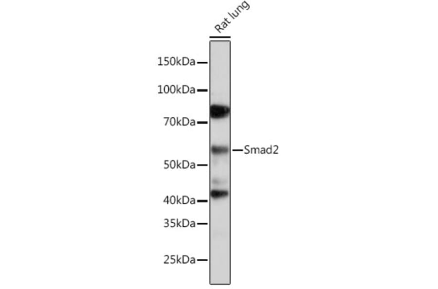 Western Blot - Anti-Smad2 Antibody [ARC0343] (A307856) - Antibodies.com