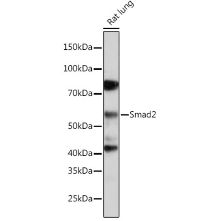 Western Blot - Anti-Smad2 Antibody [ARC0343] (A307856) - Antibodies.com