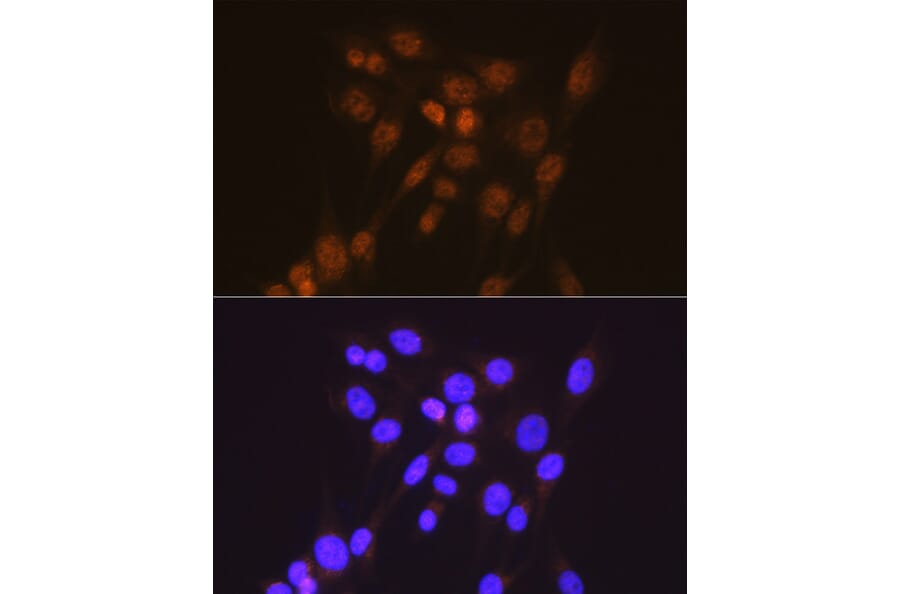 Immunofluorescence - Anti-Smad2 Antibody [ARC0343] (A307856) - Antibodies.com
