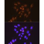 Immunofluorescence - Anti-Smad2 Antibody [ARC0343] (A307856) - Antibodies.com