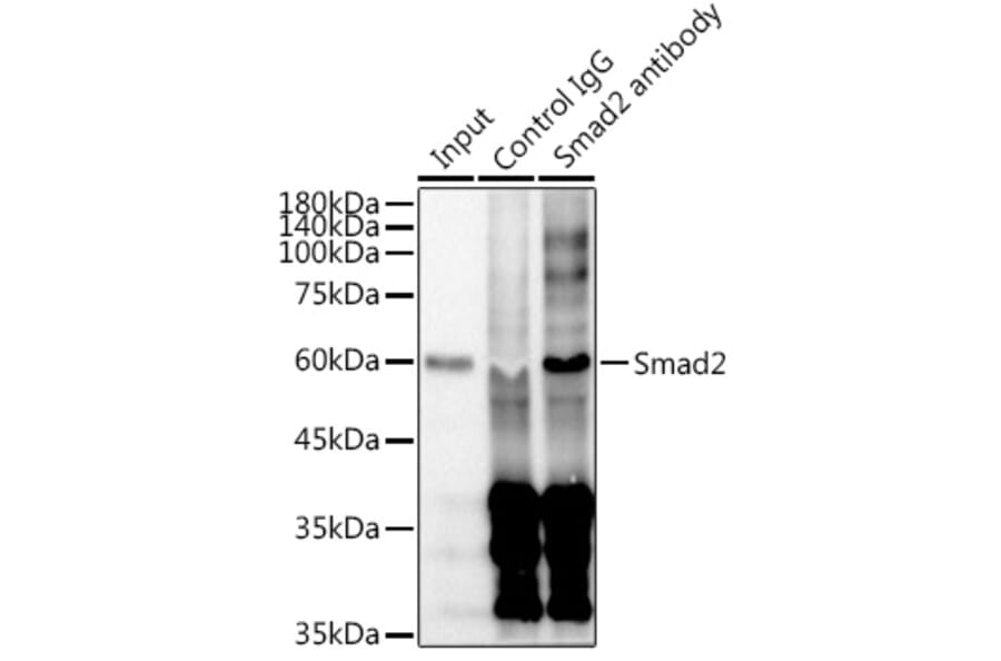 Western Blot - Anti-Smad2 Antibody [ARC0343] (A307856) - Antibodies.com