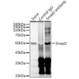 Western Blot - Anti-Smad2 Antibody [ARC0343] (A307856) - Antibodies.com