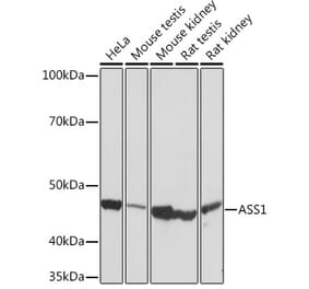 Western Blot - Anti-ASS1 Antibody [ARC1407] (A307857) - Antibodies.com