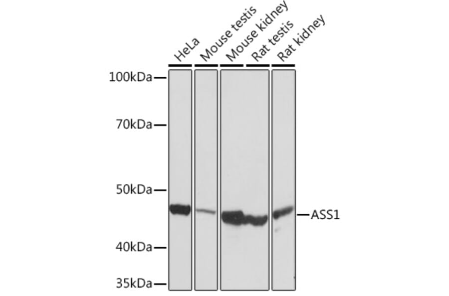 Western Blot - Anti-ASS1 Antibody [ARC1407] (A307857) - Antibodies.com