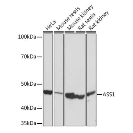 Western Blot - Anti-ASS1 Antibody [ARC1407] (A307857) - Antibodies.com