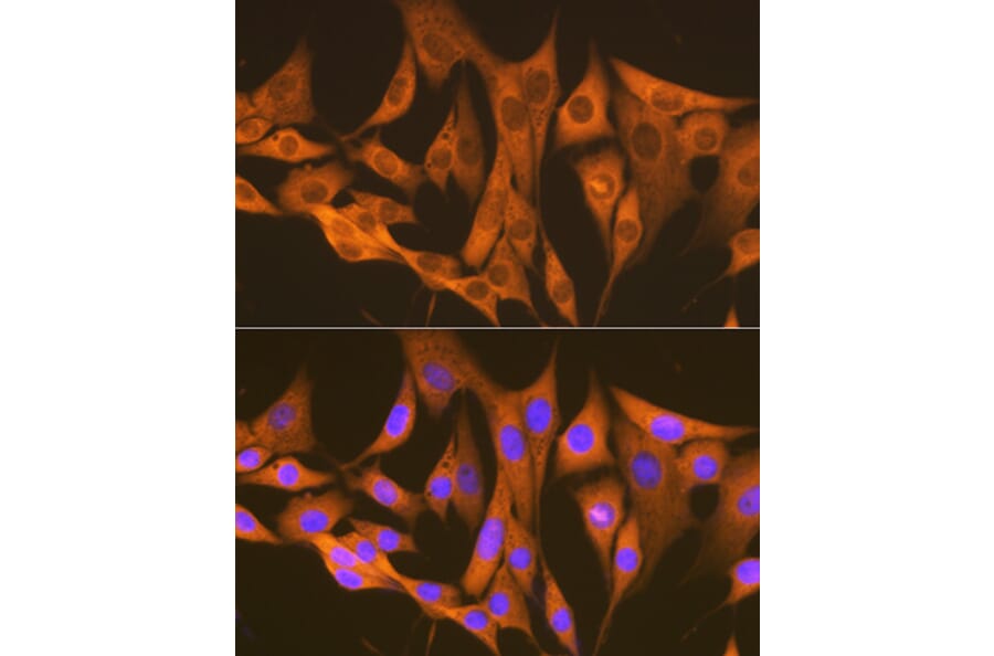 Immunofluorescence - Anti-ASS1 Antibody [ARC1407] (A307857) - Antibodies.com