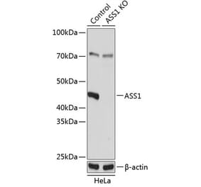 Western Blot - Anti-ASS1 Antibody (A307858) - Antibodies.com