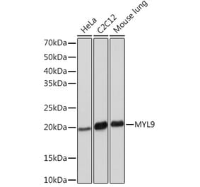 Western Blot - Anti-MYL9 Antibody [ARC1284] (A307859) - Antibodies.com