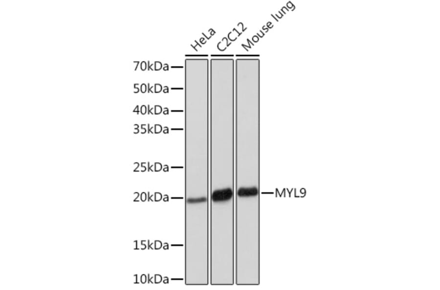 Western Blot - Anti-MYL9 Antibody [ARC1284] (A307859) - Antibodies.com