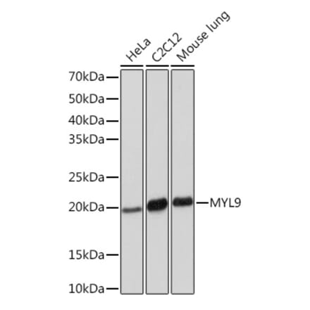 Western Blot - Anti-MYL9 Antibody [ARC1284] (A307859) - Antibodies.com