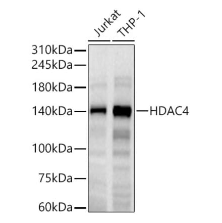 Western Blot - Anti-HDAC4 Antibody [ARC0714] (A307862) - Antibodies.com
