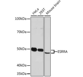 Western Blot - Anti-Estrogen Related Receptor alpha Antibody [ARC0919] (A307863) - Antibodies.com