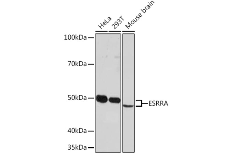 Western Blot - Anti-Estrogen Related Receptor alpha Antibody [ARC0919] (A307863) - Antibodies.com