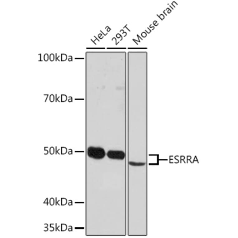 Western Blot - Anti-Estrogen Related Receptor alpha Antibody [ARC0919] (A307863) - Antibodies.com