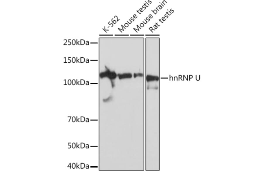 Western Blot - Anti-hnRNP U/p120 Antibody [ARC0942] (A307864) - Antibodies.com