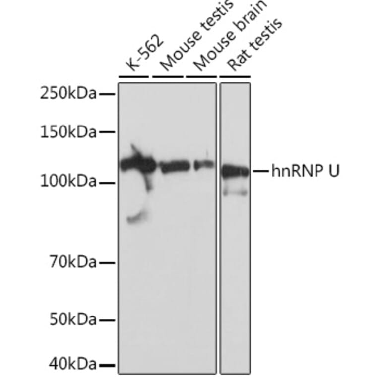 Western Blot - Anti-hnRNP U/p120 Antibody [ARC0942] (A307864) - Antibodies.com