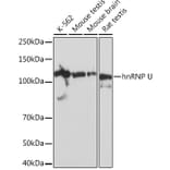 Western Blot - Anti-hnRNP U/p120 Antibody [ARC0942] (A307864) - Antibodies.com