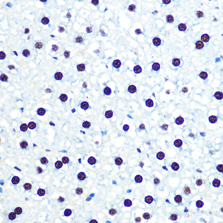 Immunohistochemistry - Anti-hnRNP U/p120 Antibody [ARC0942] (A307864) - Antibodies.com