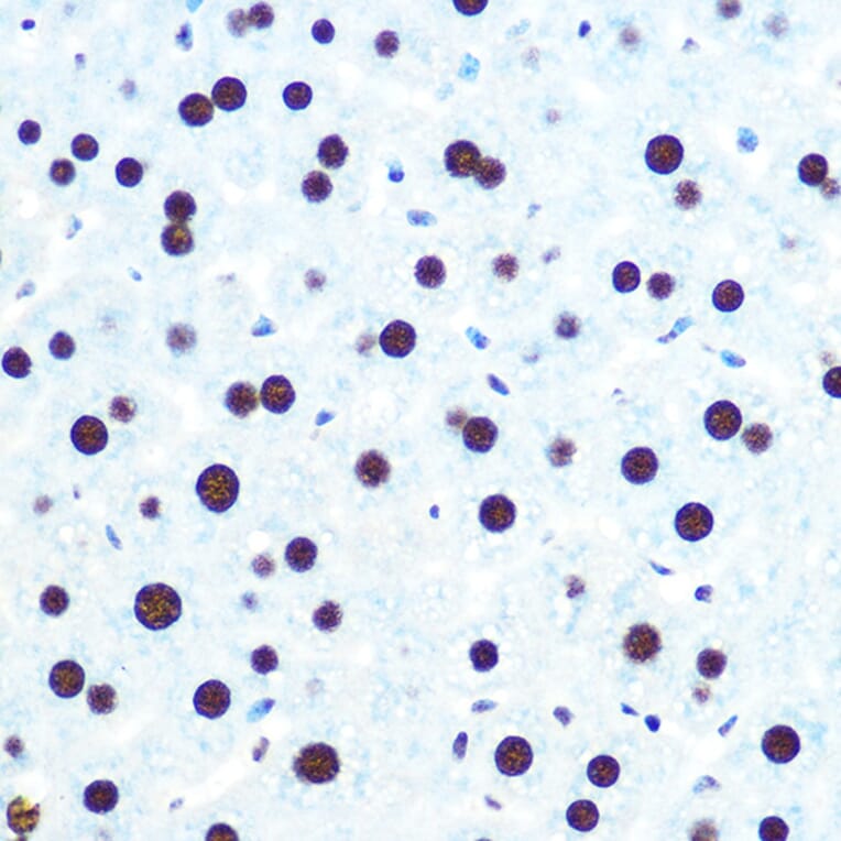 Immunohistochemistry - Anti-hnRNP U/p120 Antibody [ARC0942] (A307864) - Antibodies.com