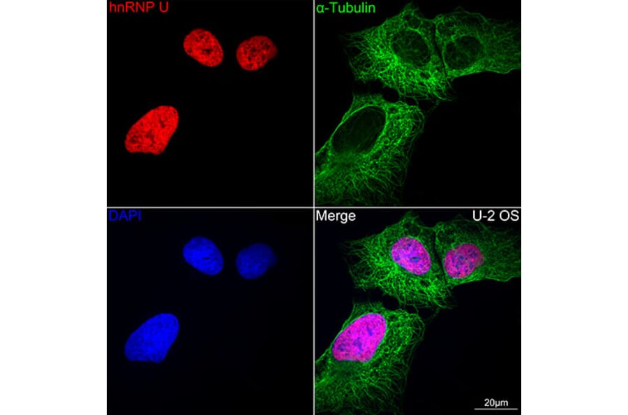 Immunofluorescence - Anti-hnRNP U/p120 Antibody [ARC0942] (A307864) - Antibodies.com
