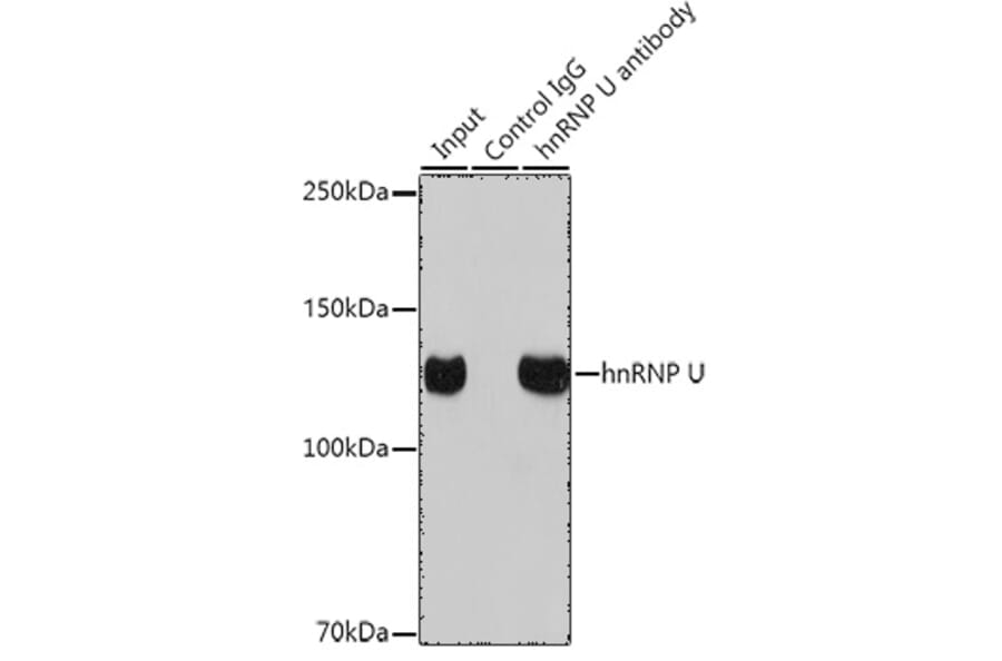 Western Blot - Anti-hnRNP U/p120 Antibody [ARC0942] (A307864) - Antibodies.com